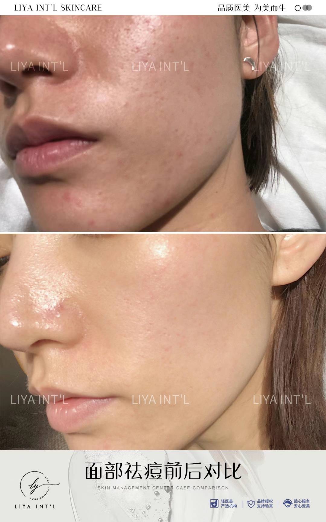 Liya Int'L Skincare gallery image