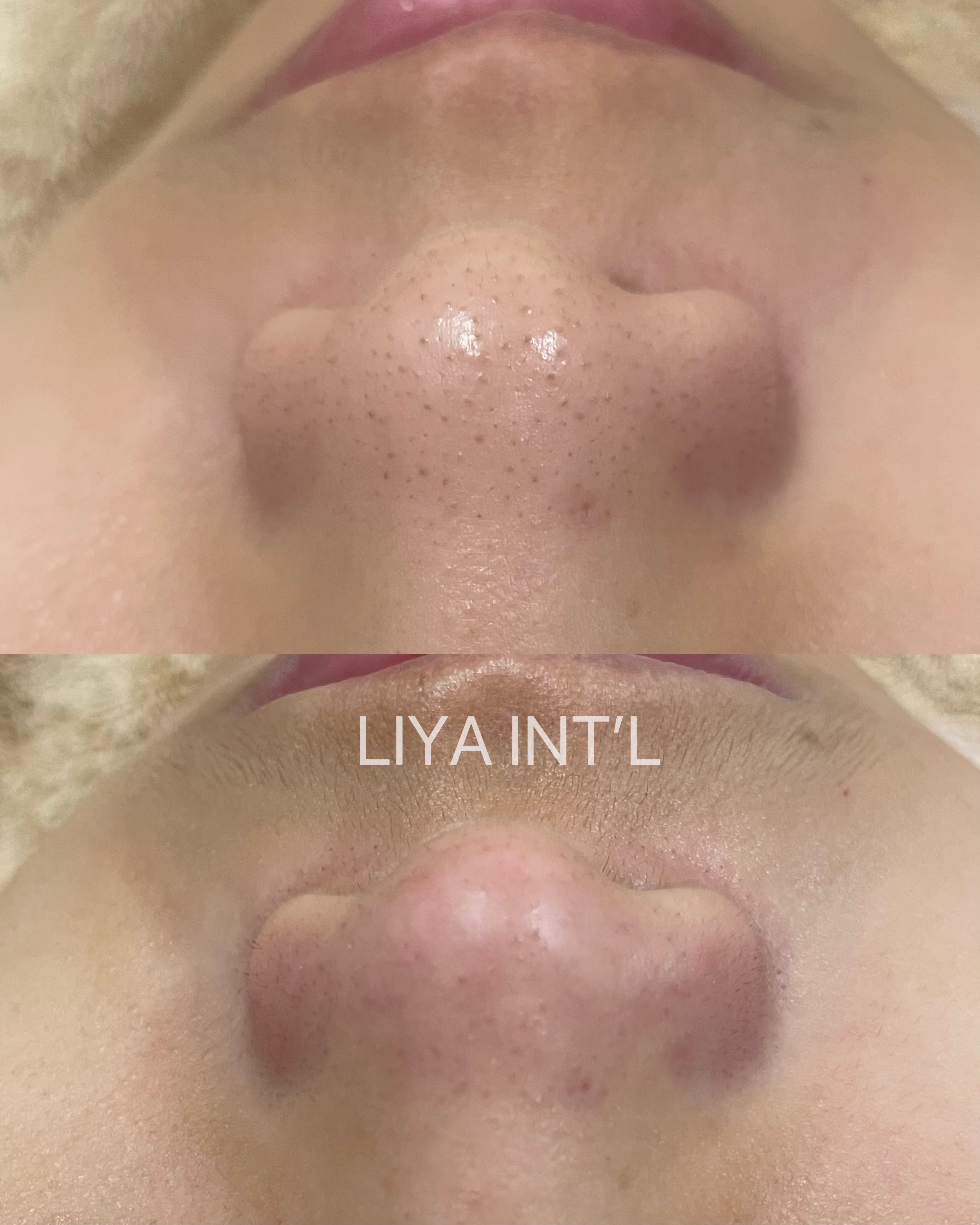 Liya Int'L Skincare gallery image