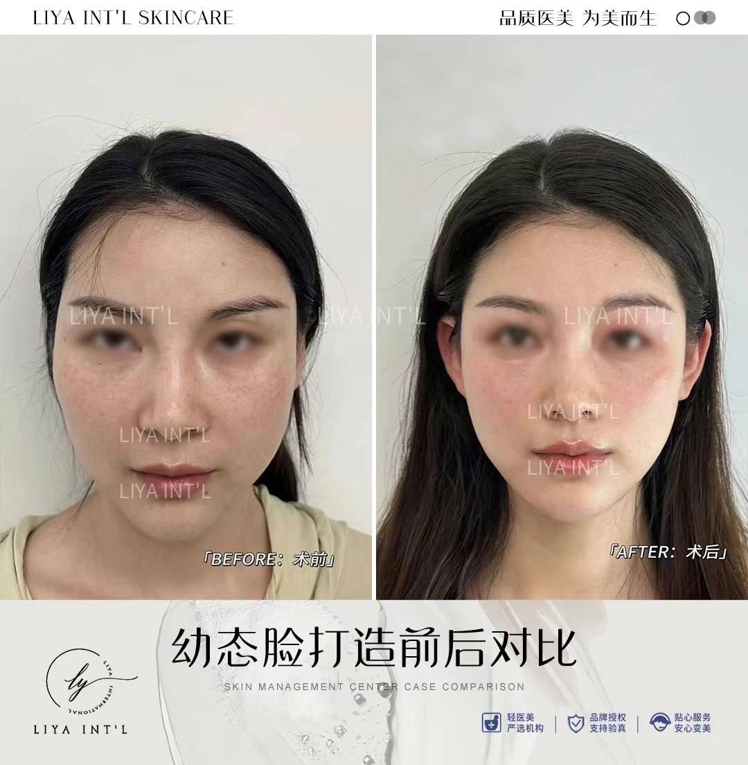 Liya Int'L Skincare gallery image